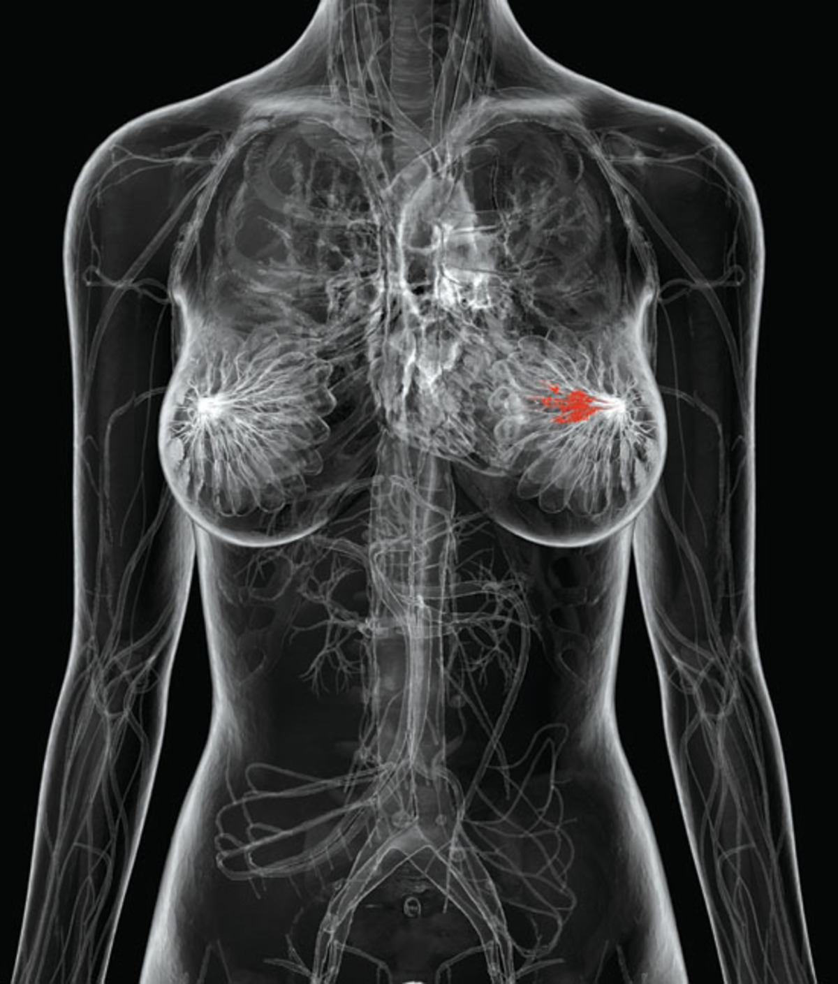 причины болезни груди у женщин фото 115