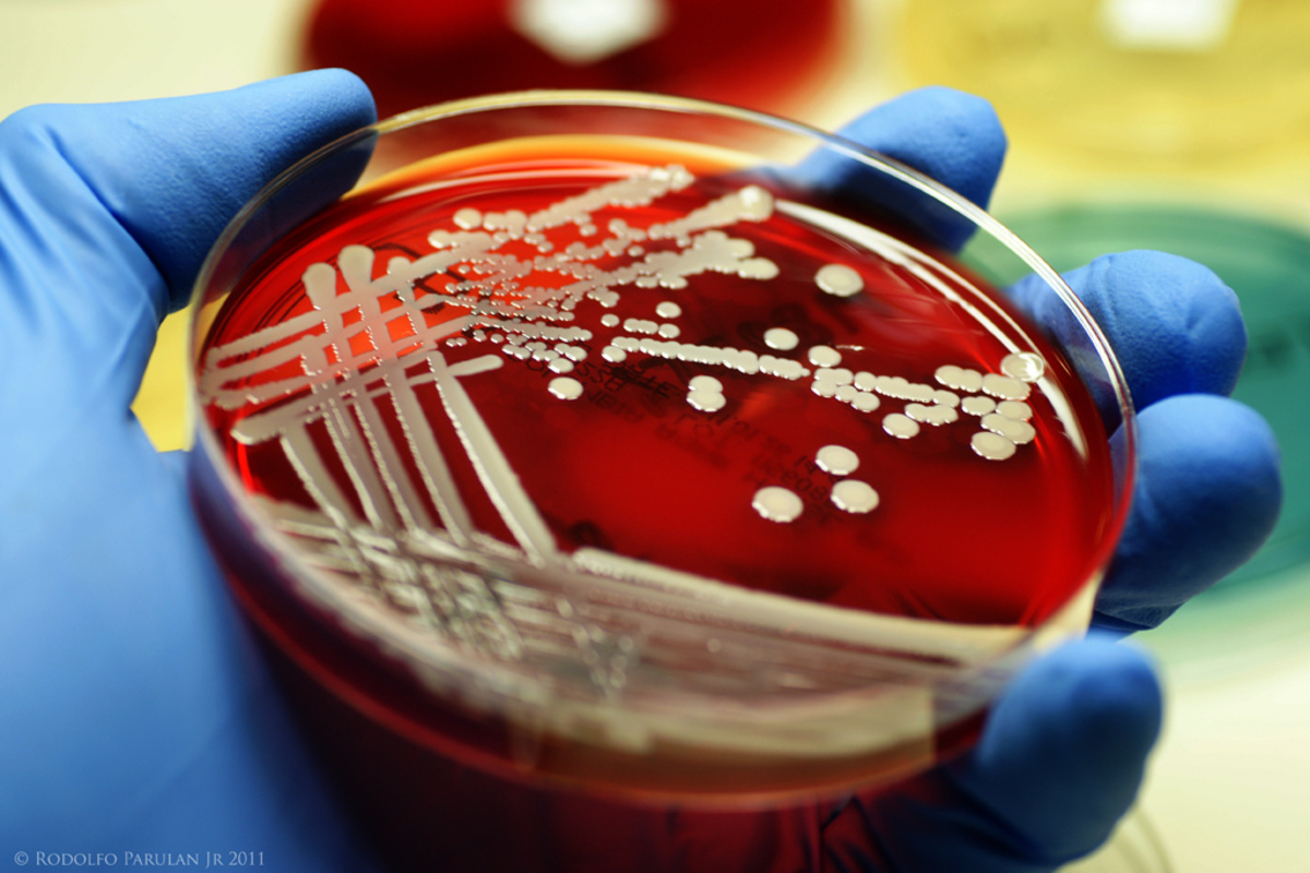 Пища стафилококка. Staphylococcus aureus на чашке Петри. Золотистый стафилококк на чашке Петри. Культуральное исследование золотистый стафилококк. Посев на золотистый стафилококк.