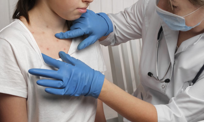 γιατρός εξετάζει κορίτσι για ιλαρά
